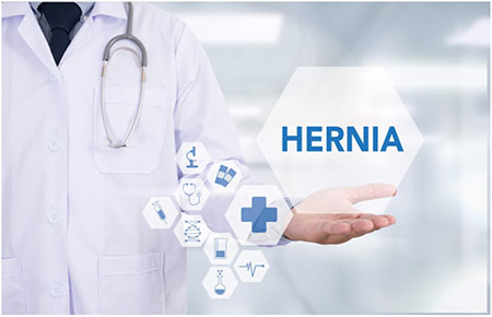 Minimally Invasive Hernia Surgery